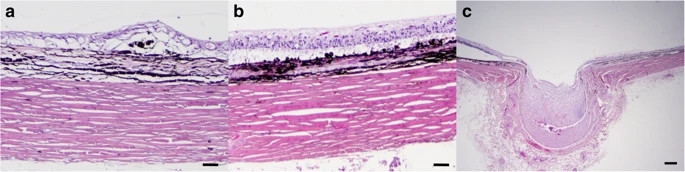 12917_2019_1812_Fig3_HTMLwebp.jpg 12917_2019_1812_Fig3_HTMLwebp.jpg