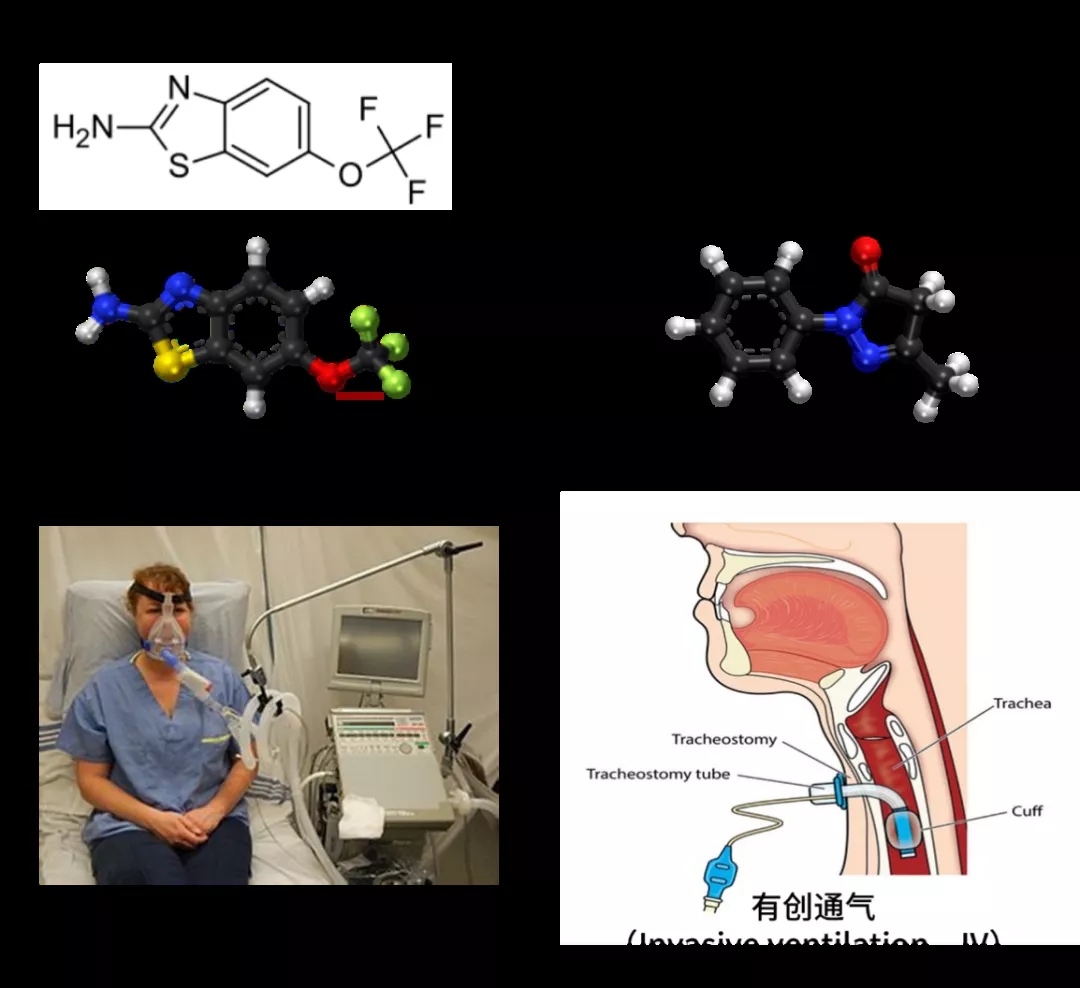 图5.  ALS的治疗手段[2]