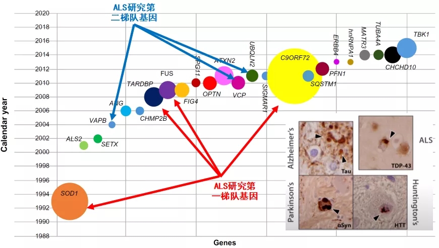 图2. TDP-43沉积和ALS的相关基因的陆续发现[4]