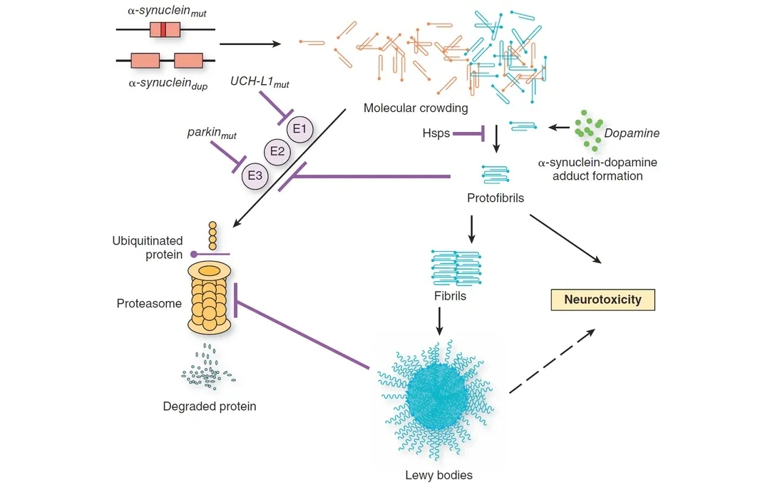 图2. 帕金森病的发病假说