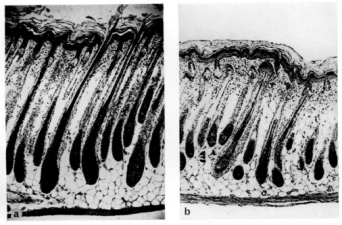 图1. 左图为正常小鼠6天大时背部皮肤纵向切片，显示毛囊有完全角化的毛发；右图为6日龄裸鼠皮肤切片显示毛囊有不正常的角化毛发，在真皮上部弯曲