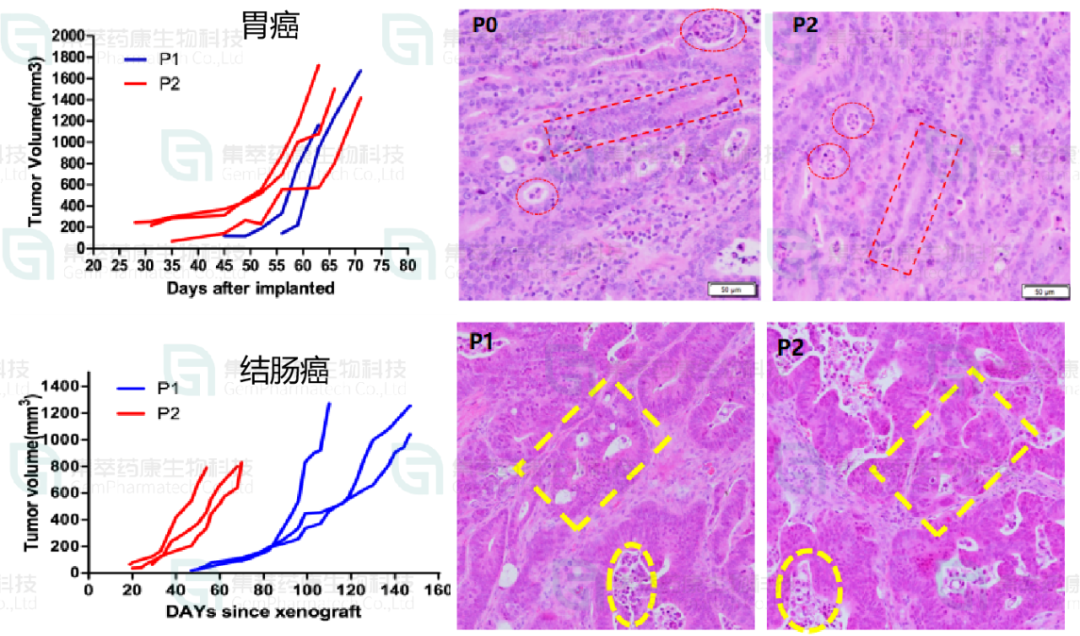 图6. NCG小鼠体内建立胃癌和骨肉瘤的PDX模型。右上红色方框标记的是胃癌的腺管，右下红色箭头标记的骨肉瘤的分裂相。
