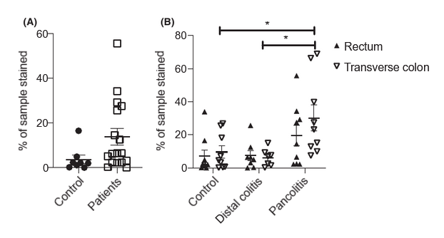 图1 结肠IL-10表达模式(A)对照组和UC患者直肠IL-10表达的比较(B)对照组、肠远端病变的UC患者和广泛性结肠炎的UC患者直肠和横结肠中IL-10表达的评估.png