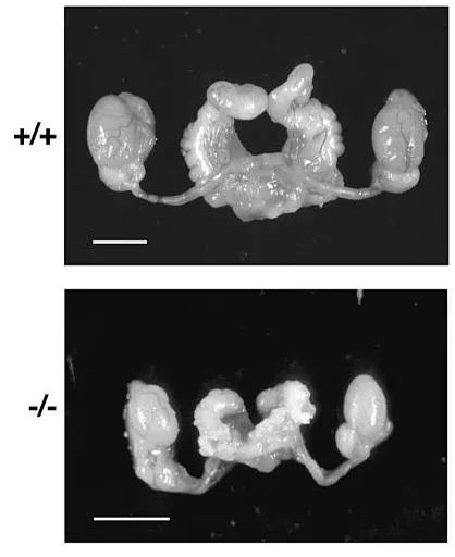 图3 9周龄的野生型和Fus--小鼠雄性的内生殖器显微照片webp.jpg