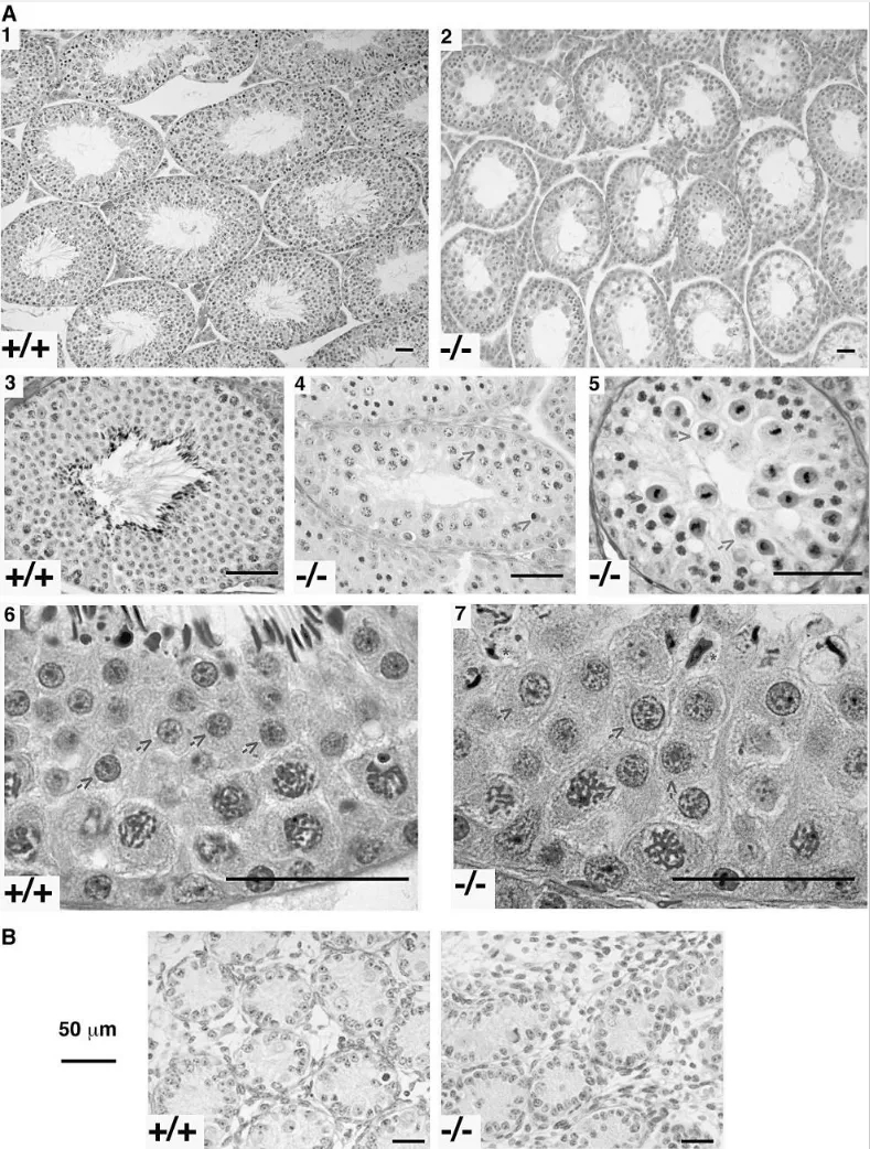 图4 Fus缺陷与精子发生缺陷有关webp.jpg