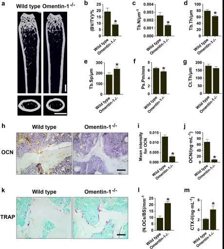 Omentin-1基因敲除小鼠