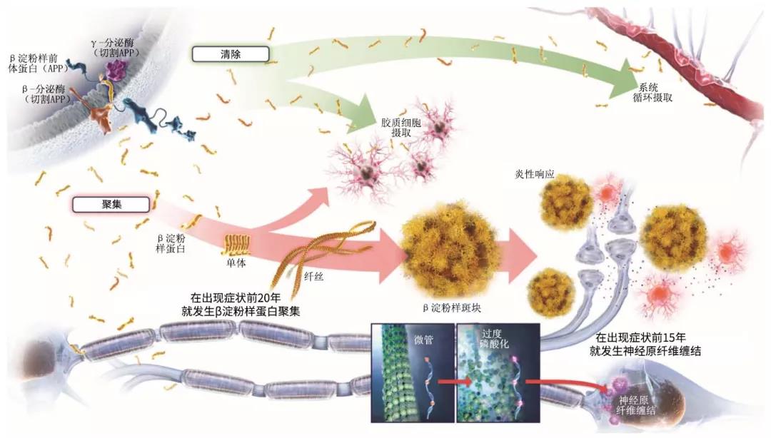 阿尔兹海默病与Psen1基因编辑小鼠