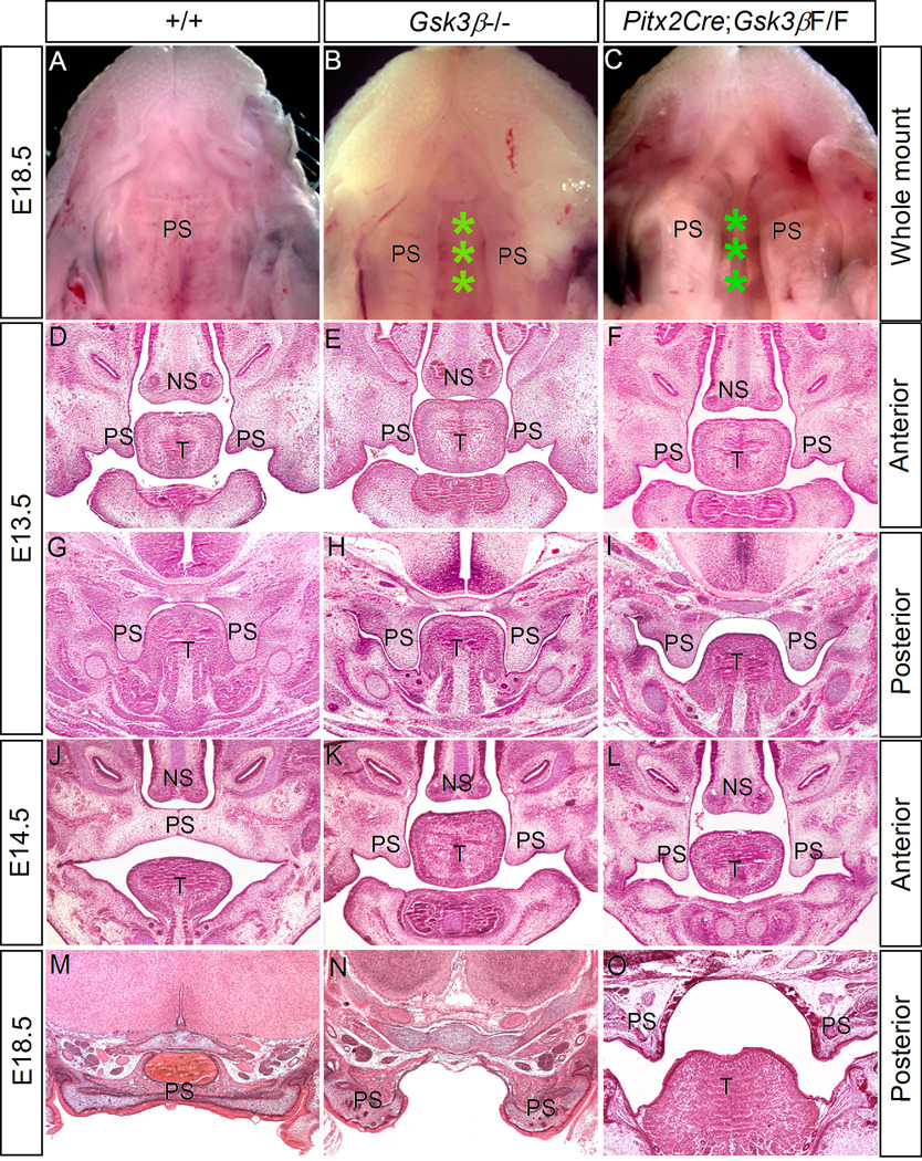Gsk3b基因敲除小鼠