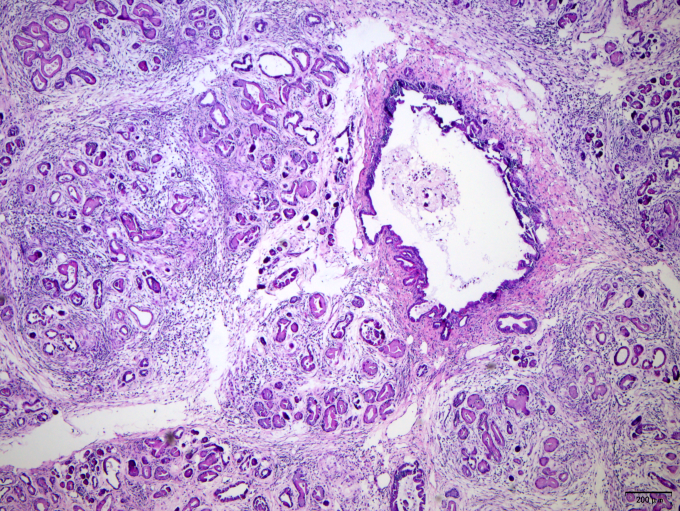 自发性肿瘤小鼠