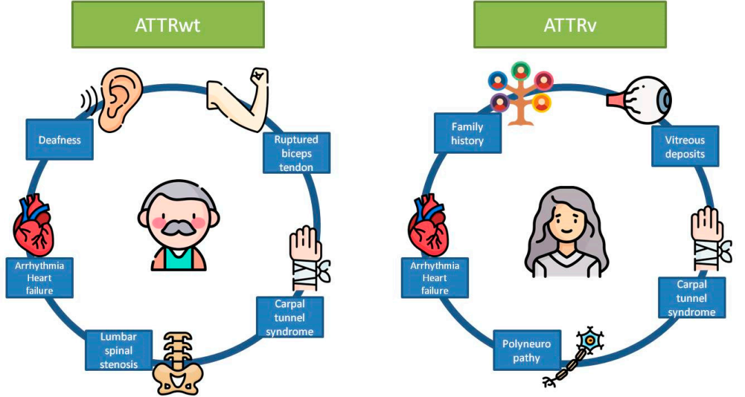 hTTR&hTTR V50M人源化小鼠