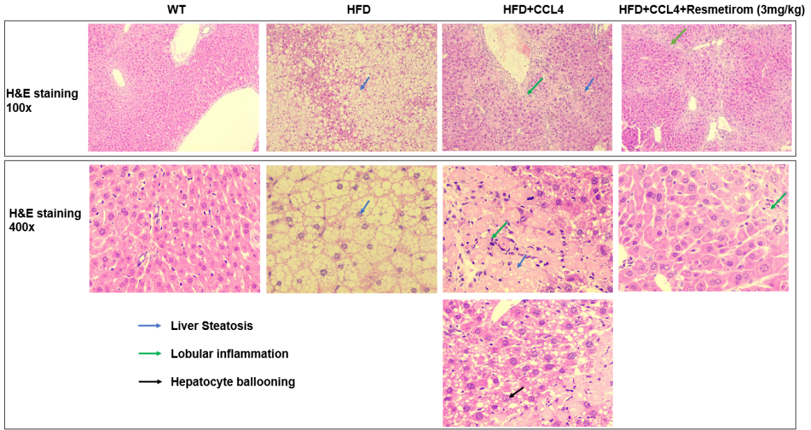 MASH（NASH）小鼠