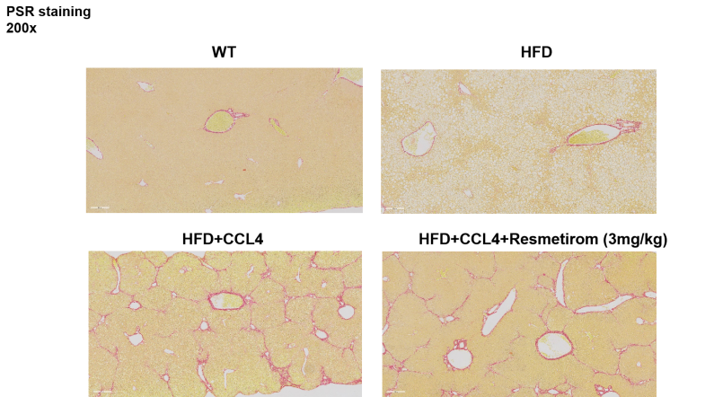MASH（NASH）小鼠
