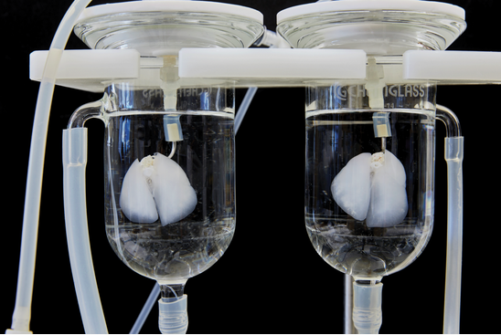 QQ 截图 20180303093515