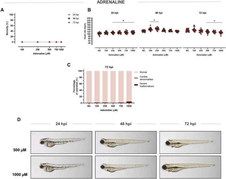 1-s20-S075333222200083X-gr3.jpg 1-s20-S075333222200083X-gr3.jpg