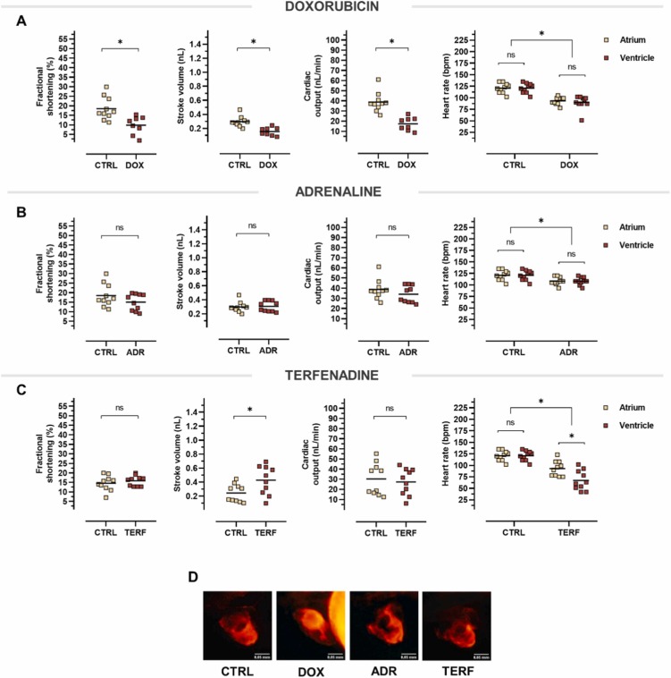 1-s20-S075333222200083X-gr5.jpg 1-s20-S075333222200083X-gr5.jpg