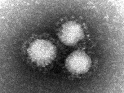 MERS或将能被有效医治 首次动物实验获得成功