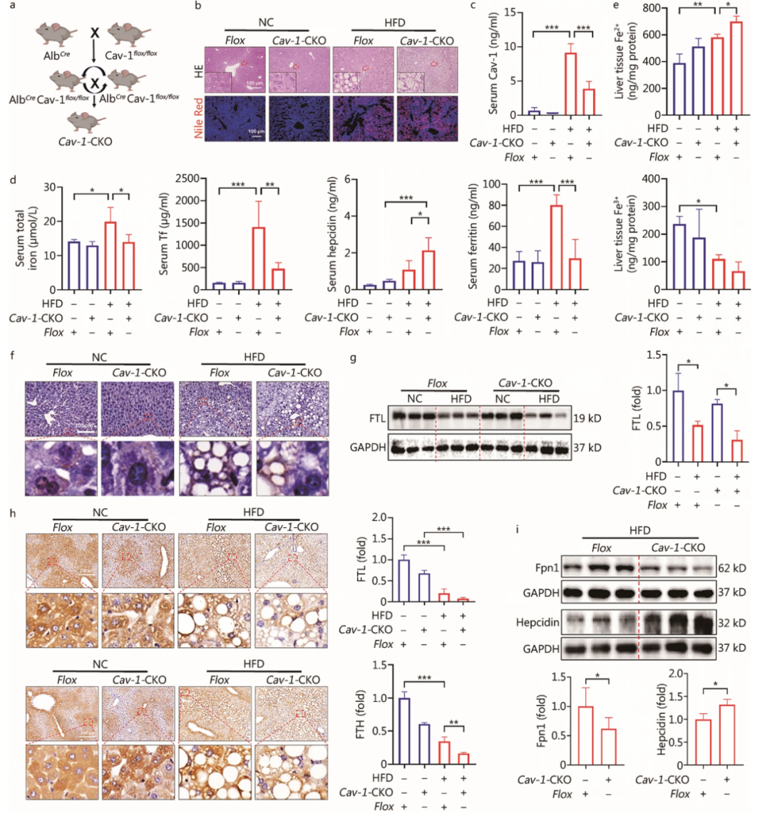 南方医科大学团队新发现Cav-1在调控NAFLD进展中的关键作用 南方医科大学团队新发现Cav-1在调控NAFLD进展中的关键作用