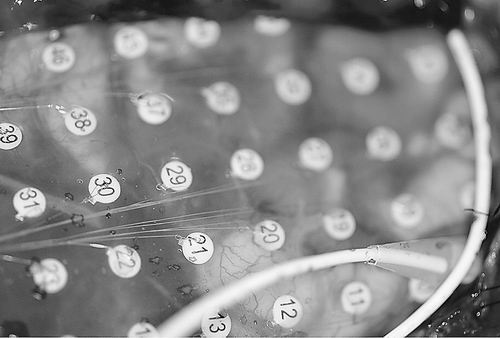 美国科学家开发电子设备修复人类损伤的记忆