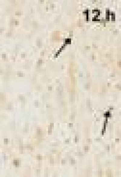 我国学者初步揭示脑创伤后海马神经元损伤机制