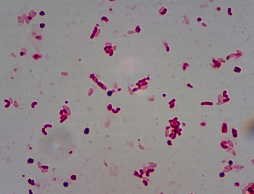 郑州大学证实miRNA能够抑制甲基丙二酸诱导的神经细胞凋亡