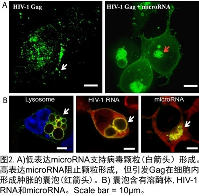 北大在PNAS报道microRNA可非特异地抵御HIV病毒感染