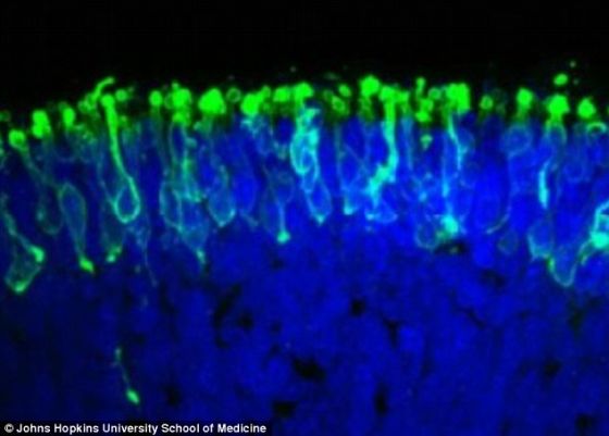 美国马里兰州科学家制造出一个光敏培养皿眼睛。这些研究人员称，这个三维结构代表着恢复盲人视力的研究向前迈出第一步。照片展示了科学家用人体干细胞制造出的一个微型视网膜结构内的光感受器(绿色)。