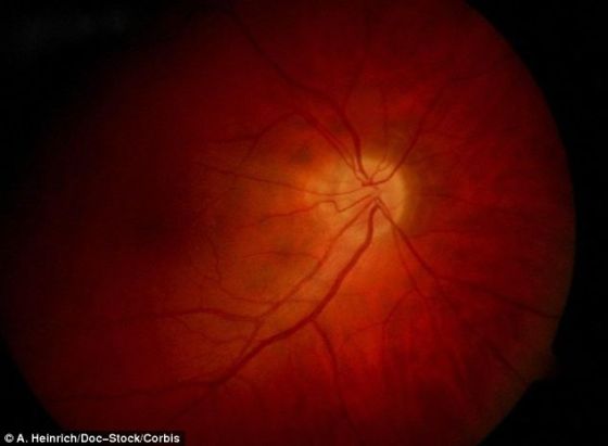 照片展示了红色视网膜。美国马里兰州约翰-霍普金斯大学医学院的坎托-索莱尔博士表示：“我们用一个培养皿制造出一个微型人眼视网膜。它不仅有视网膜的组织结构，还具有感应光的能力。这项研究为视力恢复研究提供机会，最终可能帮助科学家研发出恢复视网膜疾病患者视力的技术。”