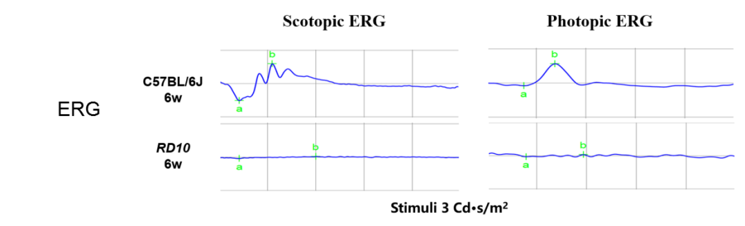 视网膜色素变性