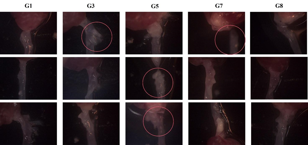 动脉粥样硬化小鼠