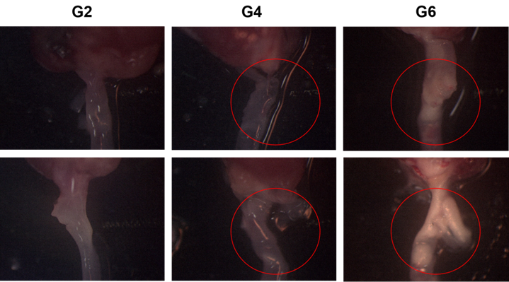 动脉粥样硬化小鼠 动脉粥样硬化小鼠