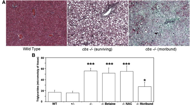 同型半胱氨酸尿症 同型半胱氨酸尿症