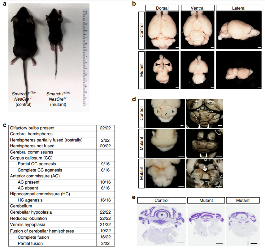 Kufor-Rakeb 综合征