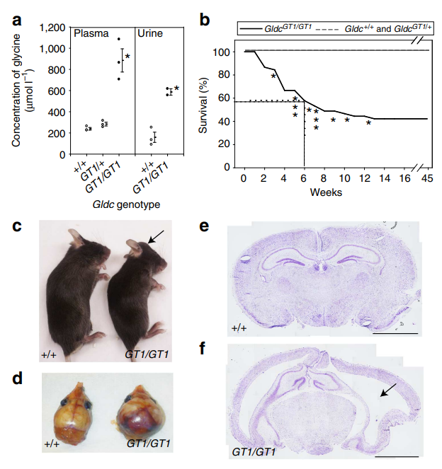 Kufor-Rakeb 综合征
