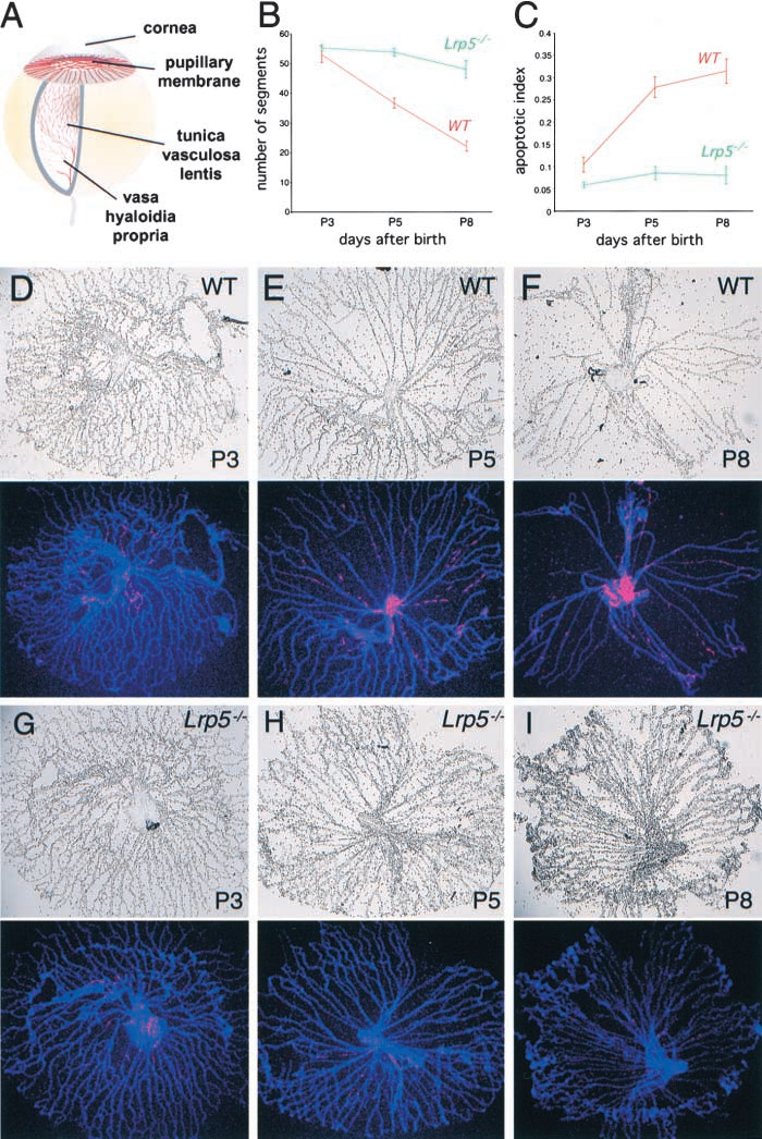 家族性渗出性玻璃体视网膜病变