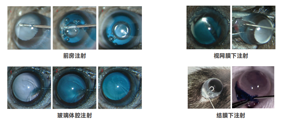 眼科基因治疗行业