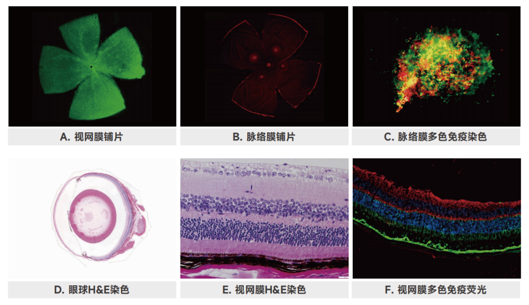 眼科基因治疗行业