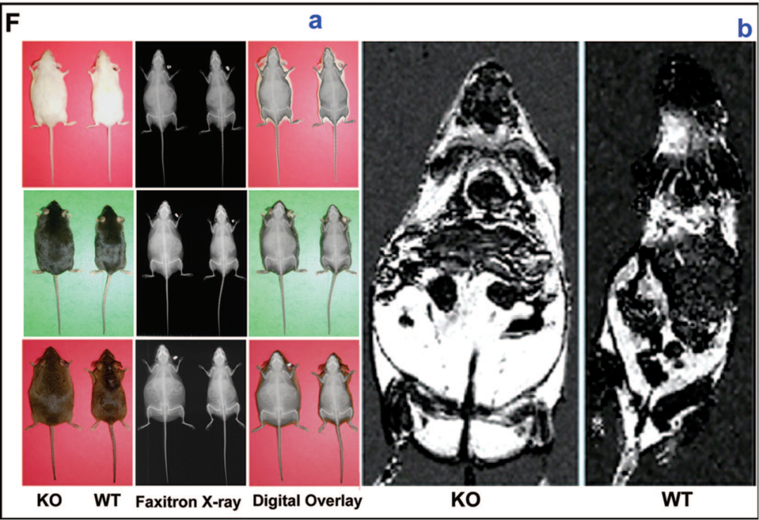 非LEP/LEPR遗传模型