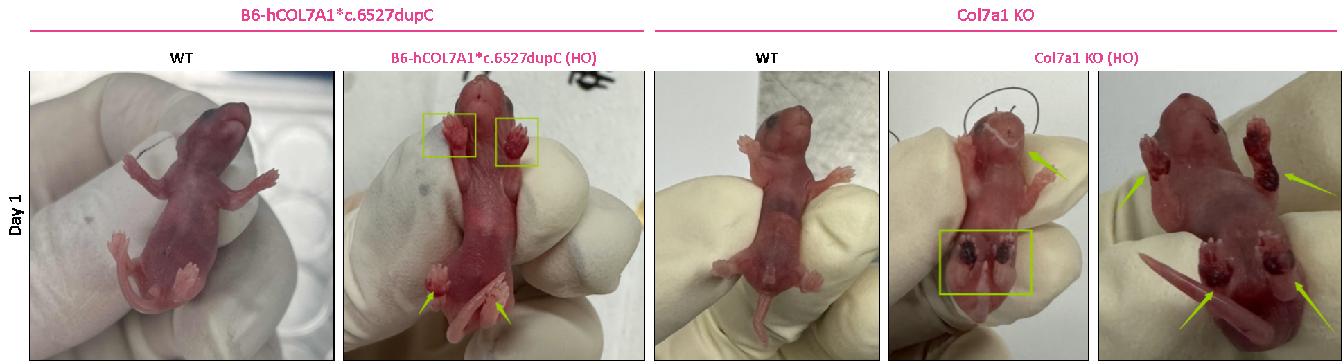 营养不良性大疱性表皮松解症(DEB)研究新模型 营养不良性大疱性表皮松解症(DEB)研究新模型