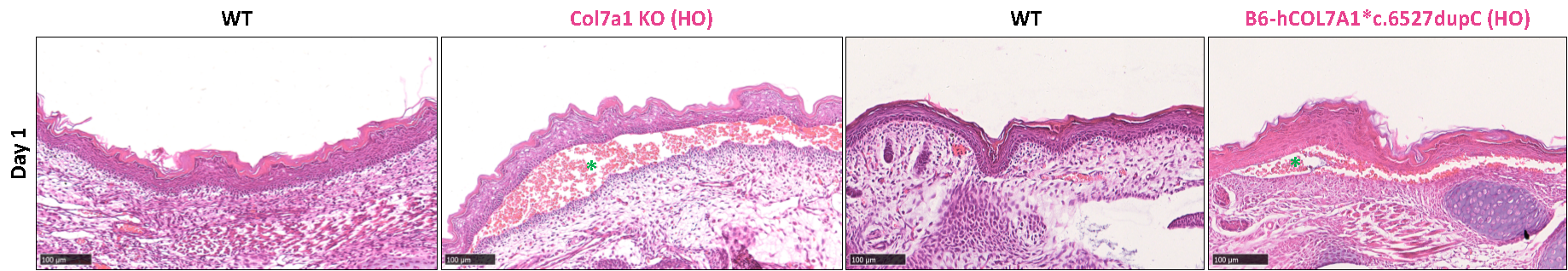 图5 Col7a1 KO小鼠和B6-hCOL7A1*c.6527dupC小鼠出现皮肤红肿和脱落表型 图5 Col7a1 KO小鼠和B6-hCOL7A1*c.6527dupC小鼠出现皮肤红肿和脱落表型