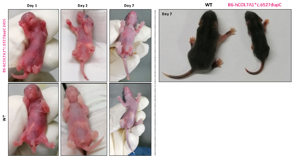 营养不良性大疱性表皮松解症(DEB)研究新模型 营养不良性大疱性表皮松解症(DEB)研究新模型