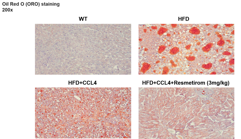 小鼠模型带来的代谢疾病与肿瘤免疫关系新视角