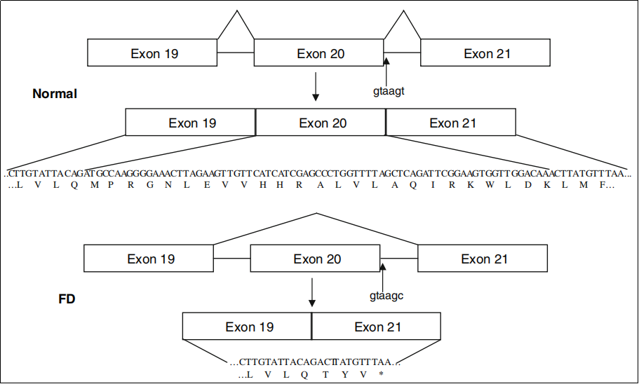 自主神经功能障碍人源化模型