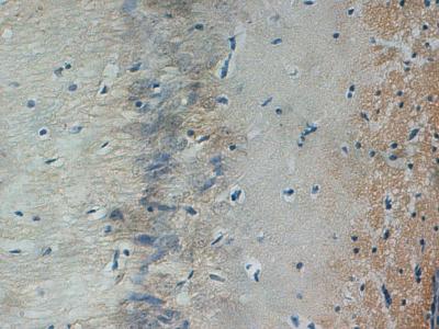 自噬活化可增加血管性痴呆模型大鼠海马神经元损伤