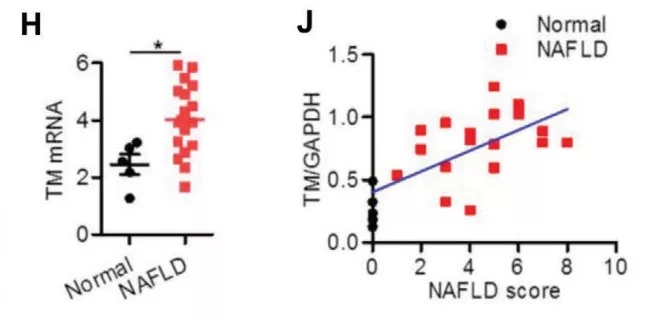 图1. 正常个体与NAFLD患者肝脏TMEM16A mRNA的水平(H)。对人类受试者TMEM16A蛋白表达与NAFLD评分之间关系的Pearson相关性分析(J)。