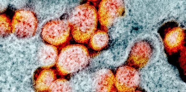 微信图片_20200430092358.jpg 微信图片_20200430092358.jpg