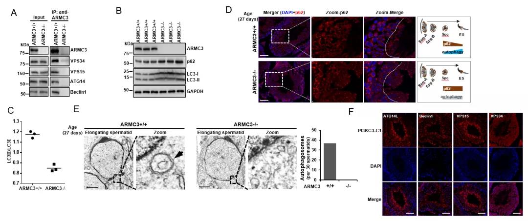 生殖组织特异性自噬