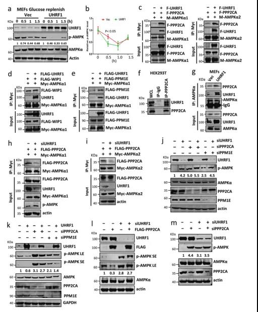 UHRF1调控糖脂代谢