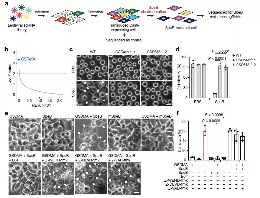 化脓链球菌感染免疫应答机制