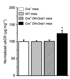 蛋白尿病情与ORAIs表达和活性密切相关