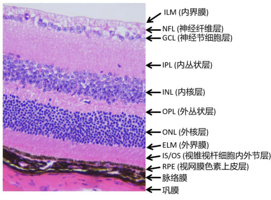 AAV基因治疗在眼科疾病研究中的应用及常见注射方式